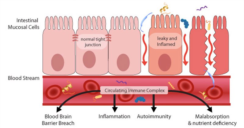 inflammation of epithelium of cell, between cell and cell surface