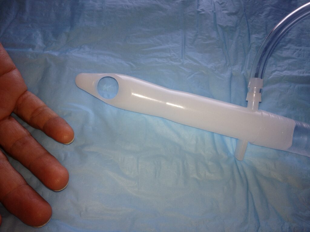 Speculum with fingers